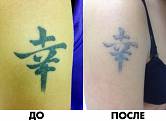 до и после первой процедуры лазерного удаления тату